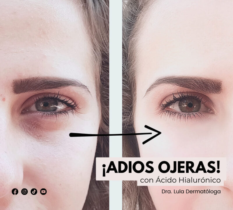 MASCARA OJERAS ACIDO HIALURÓNICO X10 PAR